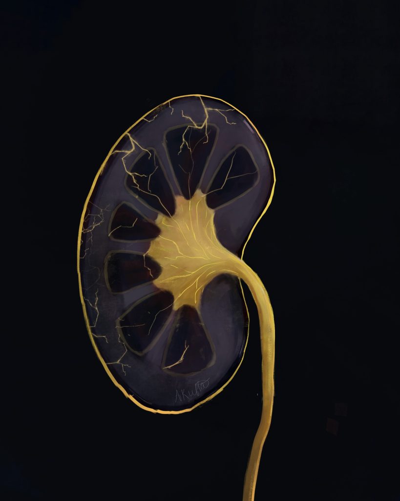 Kidney Kingsugi Digital painting, gold and black color scheme