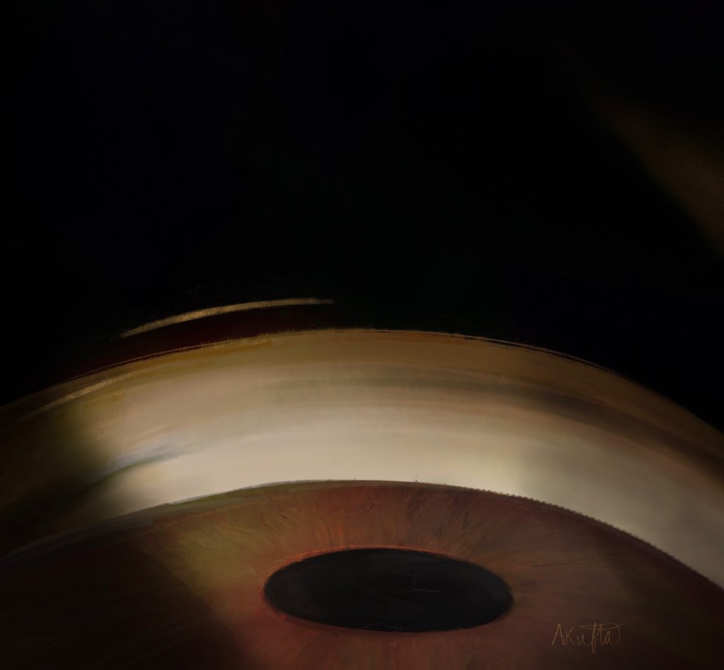 Gonioscopy